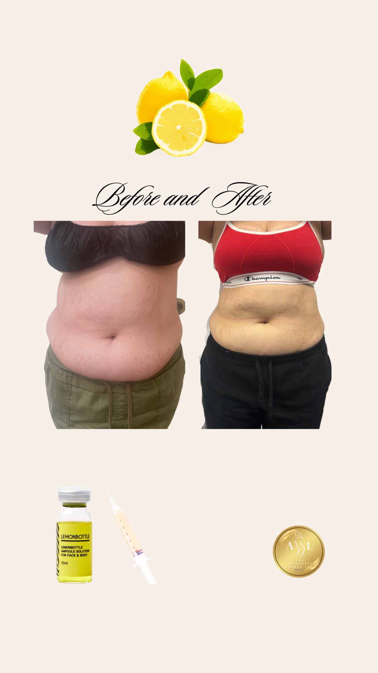 lemon bottle fat dissolving sacramento The Aesthetic Lounge LLC - Sacramento CA